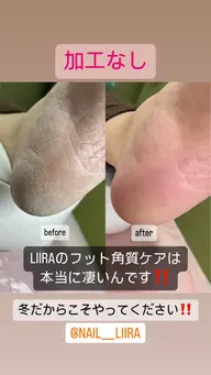 ツルツルふわふわ☺️フット角質ケア🦶✨