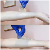 ブラジリアン(VIO)＋フェイスのセット