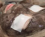 初回【ブラックカーボン光フェイシャル＋パック付き】 毛穴の開き、ニキビ、などが気になる方に♪