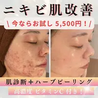 初回限定!Open 記念【毛穴/ニキビケア】ハーブピーリングお試し5500円(REVI剥離なし)