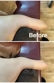 【二の腕・痩身】ミニモ限定／話題の痩身マシンで二の腕下のたるみ肉へアプローチ！