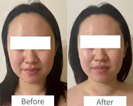 初回体験価格！モニタープラン②                              トライアングルフェイシャル®️