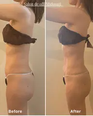 痩身燃焼マッサージ【上半身】