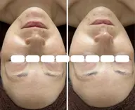 【ざらつき・くすみ改善✨透明感フェイシャル】日頃の疲れや老廃物をマッサージで流して透明感のあるお肌に