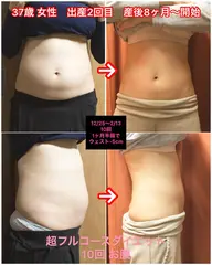 【お腹痩せ】ラジオ波&キャビ　短時間お得　所要30分