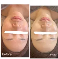 陶肌トリートメント（剥離なしハーブピーリング）再生因子コース💋リップトリートメント付