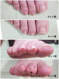 【フット】ツルスベ角質ケアのみ