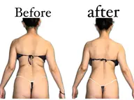 慢性的な首肩こり背中のハリや疲れ上半身の重だるさを改善する『全身ケア』