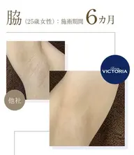 初回お試し選べる3部位【Sパーツ】