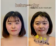 アドバンス＋エイジング☆ 小顔になりたい方に特にオススメ！顔＋首＋肩＋頭をしっかりと触ります♪