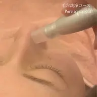 黒ずみスッキリ❣️毛穴洗浄＋ピーリング🍀