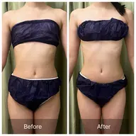 【痩身×疲労回復】痩身×筋膜×腸もみ×ヘッド💆‍♀️全身120分