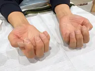 うるつるケアコース(整形＋ケア＋爪磨き＋保湿)