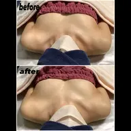 気になる左右差・離れたバストを改善します