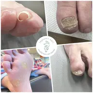 フット爪ケアコース❣️