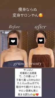 女優小顔コース(ハイパーナイフ10分付き)