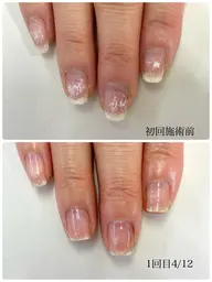 最強ネイルケア1回体験