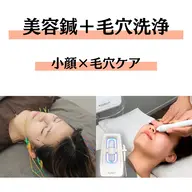 【小顔×毛穴】美容鍼+毛穴洗浄✨️