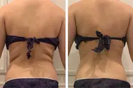 【半額❤️スリムコース‼️】脂肪撃退×即体感✨ 効果の早いハイパーナイフEXで徹底アプローチ❤️🔥