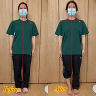 肩こり・腰痛におすすめ！筋膜リリース