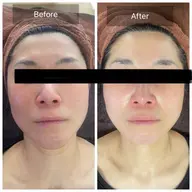 《男女OK》小顔フェイシャルorエイジングケアフェイシャル　¥4980