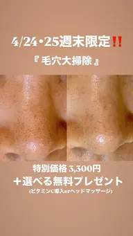 【4/25・26限定‼️】毛穴の大掃除✨毛穴洗浄＋選べる特典（ビタミンC導入orヘッド）付 3,300円