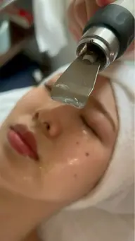 超音波毛穴洗浄🫧 ベタつき、皮脂の汚れ、黒ずみ、くすみ~敏感肌🉑