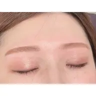 🤍おでこのWAX脱毛