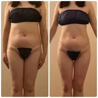 劇的変化💫むくみ・老廃物の排出を促進💨ゼロジーフリー痩身135分¥18,000