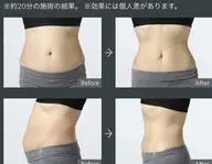 【お試し集中部分痩身】スリムダウン♪キャビスパ★お腹or腕or足集中痩身60分→8800円【キャビ&バンテージ付】