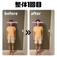 🥈姿勢改善整体+遠赤外線ドーム(ミネラルクリーム168使用)