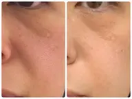 憧れの韓国白肌🐮🥛紫外線対策🥛話題の白玉ピーリング💓ニキビ/毛穴/乾燥/肌質改善/美白