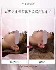 【本来の美しさへ】小顔整体体験！！