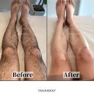 🩵男性WAX脱毛🩵両脚all　ムダ毛すっきり清潔感アップ⤴️角質も取れてつるさら脚へ🌱✨