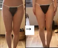 バザルトストーンO脚改善全身コース✨