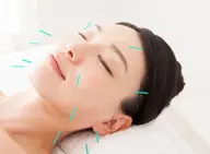 【 美容鍼 30本 】 電気パルス 小顔ストレッチ付き