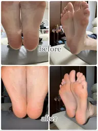 フット角質ケアスペシャルコース