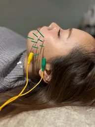 【お顔スッキリ！】光LED×電気美容鍼×美容液