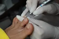 【足の専門家】肥厚爪・変形爪ケアコース40​〜​90分¥4400​〜​¥9900(お爪の状態に料金は変動)【初診料別途550円】