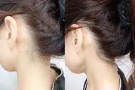 【うなじor襟足WAX脱毛】ブライダルね方にも人気♪