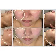 《二重顎/頬の脂肪/口横ポニョ/小顔》脂肪サヨナラ！インモード ミニfx ★「顎＋フェイスライン」or「頬＋口横」