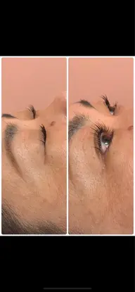 【パリジェンヌラッシュリフト】まつ毛の根元から立ち上げます。アイシャンプー&高濃度ビタミン美容液トリートメント付