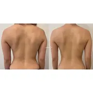 【ミニモ限定】美肌全身リンパマッサージ80分