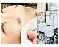 ダイヤモンドピールプログラム