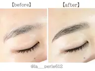 【ハリウッドブロウリフト】