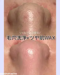 鼻の毛穴にお悩みの方💭毛穴洗浄×ツヤ肌WAX【鼻のみ】✨