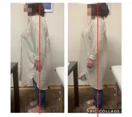 足の付け根が痛くて歩くのがつらい!お試しキャンペーン(2回で1,980円)