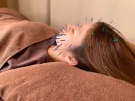 🉐【初回限定】ヒト幹細胞美容鍼