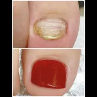 (オフなし)爪育☆フットジェルネイルご相談シンプルコース（施術時間90分）￥9,000