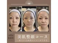 初めての美肌整顔コース